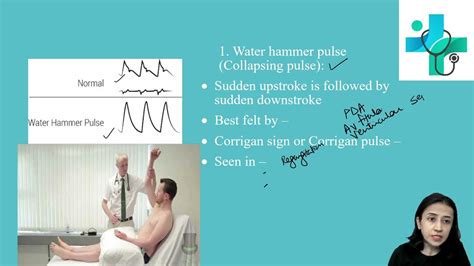 Types of Pulse | examination of pulse | clinical examination | physiology practical - YouTube