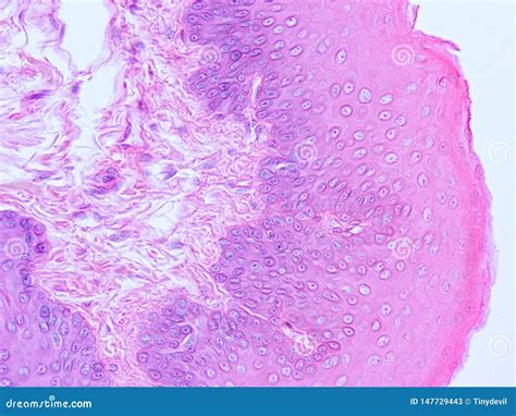 Histology Of Epiglottis Human Tissue Stock Photography | CartoonDealer ...