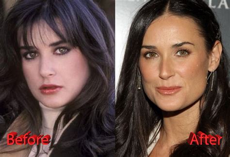 Demi Moore Plastic Surgery Gone Too Far