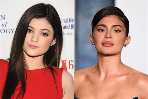 Kylie Jenner's Plastic Surgery Comments Spark Jokes, Memes - Newsweek