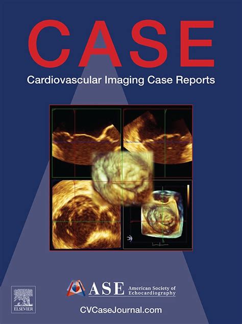 Journal of the American Society of Echocardiography