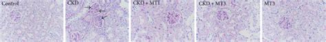 Kidney histopathology. Representative photomicrographs of PAS-stained... | Download Scientific ...