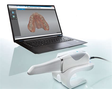 Clinica Dental Mater | Scanner Intraoral en Dental Master