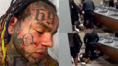 Video: Rapper Tekashi 6ix9ine Hospitalized after Savage Beating in Gym Locker Room – Fitness Volt