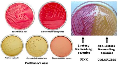 MacConkey Agar- Composition, Principle, Uses, Preparation and Colony ...