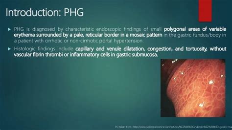 PORTAL HYPERTENSIVE GASTROPATHY