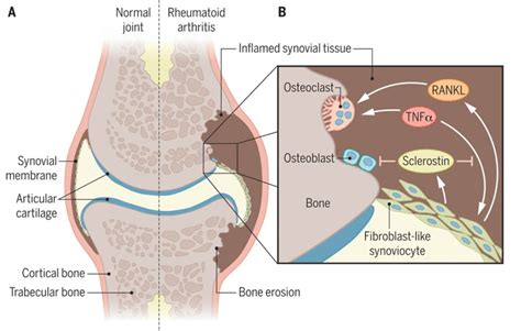 Sclerostin: More than a bone formation brake | Science Translational Medicine