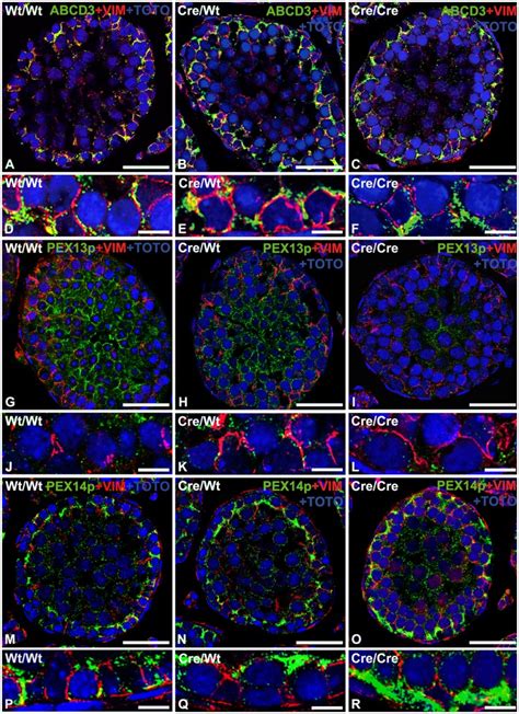 Double immunofluorescence for peroxisomal membrane proteins (green) and... | Download Scientific ...