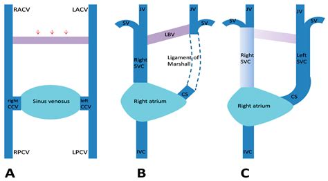 Diagnostics | Free Full-Text | Persistent Left Superior Vena Cava with ...