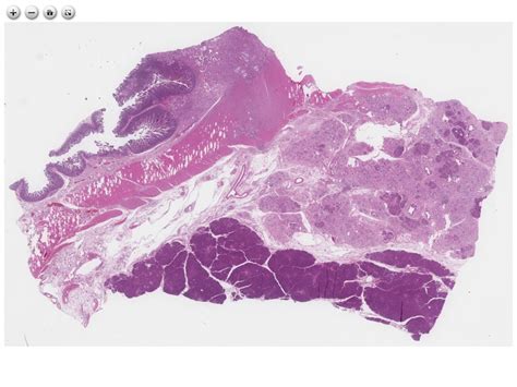 Histopathology Atlas – 40 Ampulla of Vater