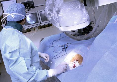 Heart pacemaker surgery - Stock Image - M560/0601 - Science Photo Library