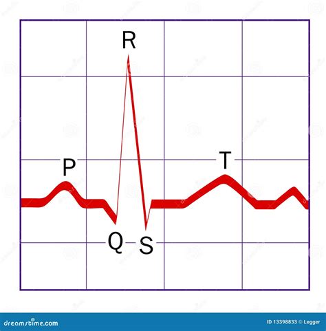 Traço de ECG ilustração stock. Ilustração de pulso, anatomia - 13398833