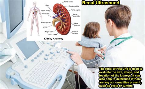 What is a Renal Ultrasound Best Procedure, Preparing 2023