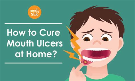 How To Relieve Mouth Ulcer Pain - Plantforce21