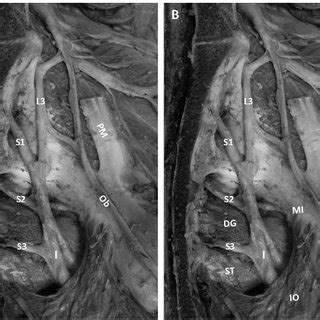 Muscle ramifications of the ischiadicus nerve on the right and left... | Download Scientific Diagram