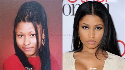 Nicki Minaj Before Plastic Surgery and After Surgery - What does nicki minaj look like