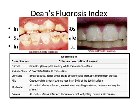 Dental Fluorosis