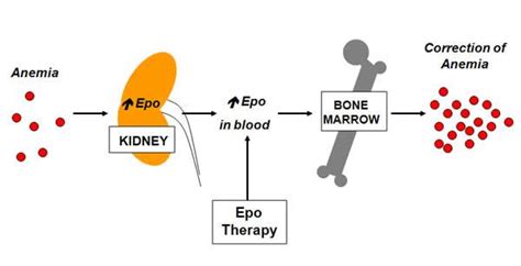 MDS Treatment: Bone Marrow Transplant, Transfusions, Vidaza & other ...