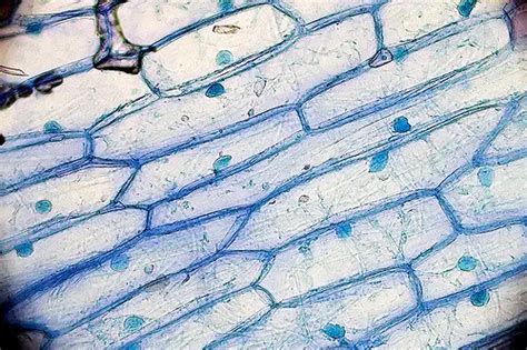 Onion Cells Under a Microscope - Requirements/Preparation/Observation