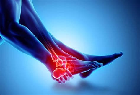 Sprained Ankles | Types, Causes & Recovery Time | OPA Ortho