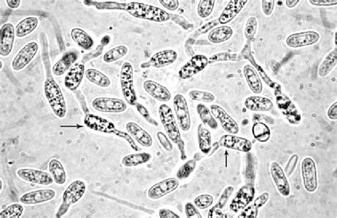 Germination of conidia of C. acutatum in the control. | Download Scientific Diagram