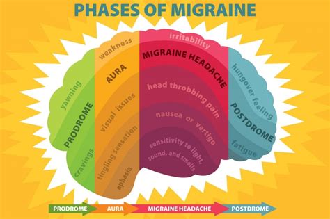 Migraine - Symptoms, Treatment & Clinical Trials - Genesis Research Services