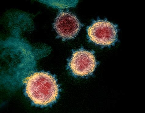 Novel coronavirus structure reveals targets for vaccines and treatments ...