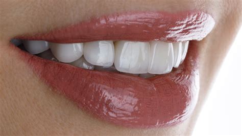 Are There Differences Between A Porcelain Veneer And Lumineers Procedure? | David M. White, DDS