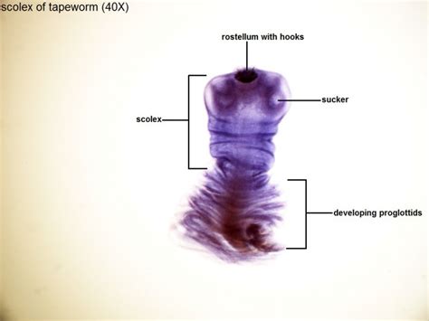 L- Tapeworm Scolex 40X-1