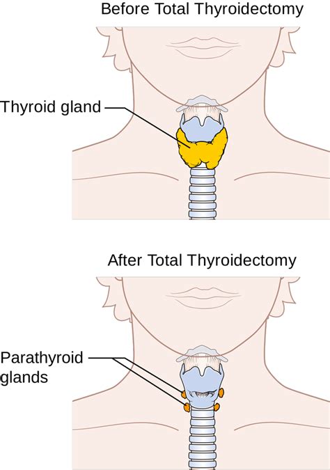 Thyroidectomy Surgery in Kharghar, Raigad | ID: 10608777648