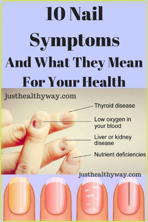 10 Nail Symptoms And What They Mean For Your Health - Just Healthy Way ...