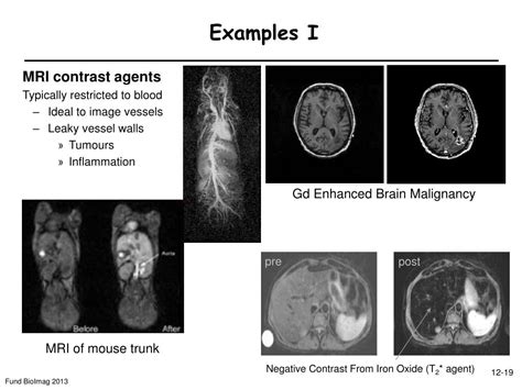 PPT - 12: MRI contrast mechanisms PowerPoint Presentation, free ...