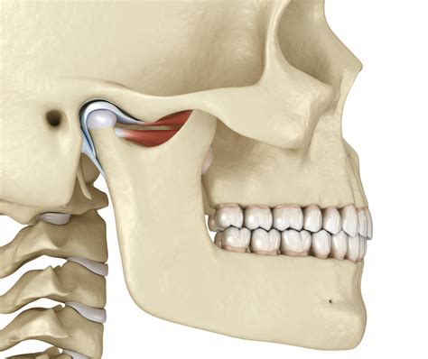 TMD/TMJ - Let's Jaw about Jaws - Pain Care Clinic LTD