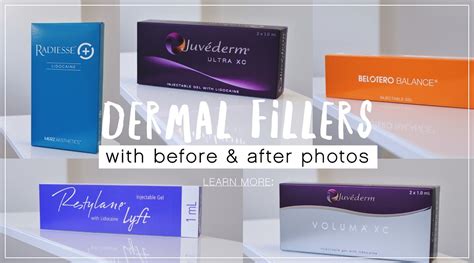 Dermal Fillers with Before & After Photos