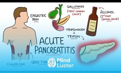 Acute Abdominal Pain Diagnosis Tutorial - Mind Luster