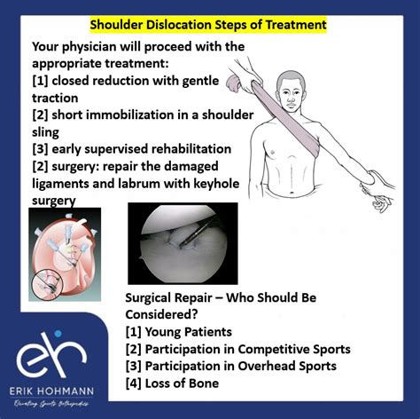 Shoulder Dislocation Steps of Treatment - Sports Injury specialist in Dubai