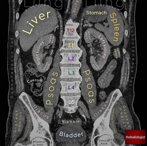 Abdominal Ct Anatomy Radiology Key - vrogue.co