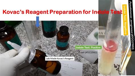 Kovac's Reagent Preparation for Indole Test of Bacteria - YouTube