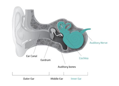 Types of Hearing Loss — Hearing Health Foundation