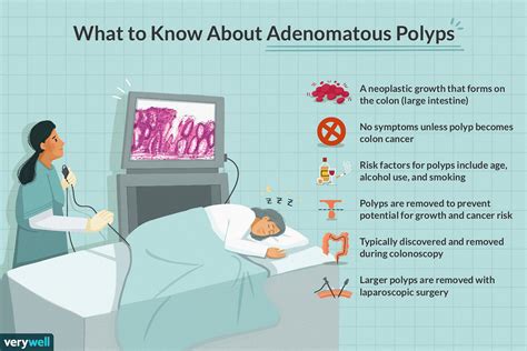 Adenomatous Polyp: Symptoms, Causes, Diagnosis, and Treatment