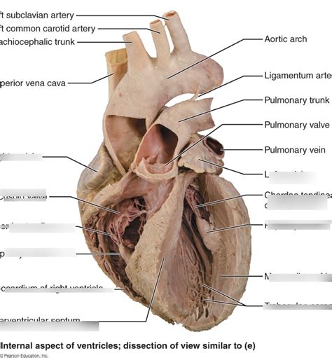 Left Ventricle Diagram | Quizlet