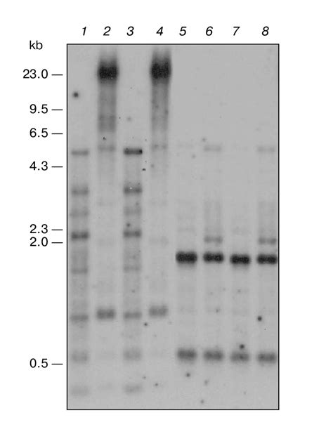 Blot-hybridization analysis of the PEP carboxylase gene of M ...