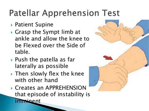 patellar tilt test