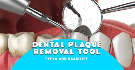 Dental Plaque Removal Tools - Types and Usability – Franklin Dental Supply