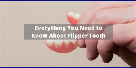 Everything You Need to Know About Flipper Tooth - iHome Dental