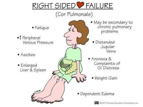 Cor Pulmonale | Nursing mnemonics, Nursing school survival, Nursing students