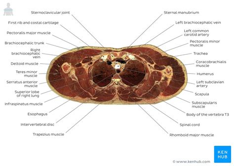 Cross sectional anatomy | Kenhub