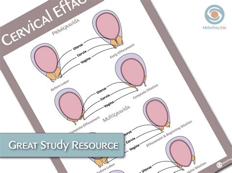 Cervical Effacement Educational Poster - Etsy UK