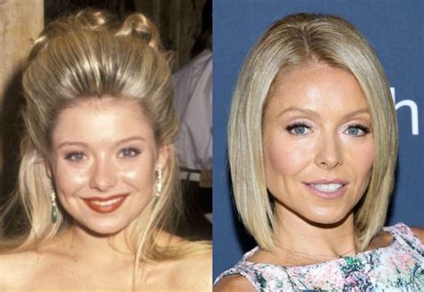 Kelly Ripa before and after plastic surgery (13) | Celebrity plastic ...