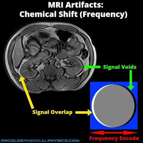 Magnetic Resonance Imaging | Oncology Medical Physics